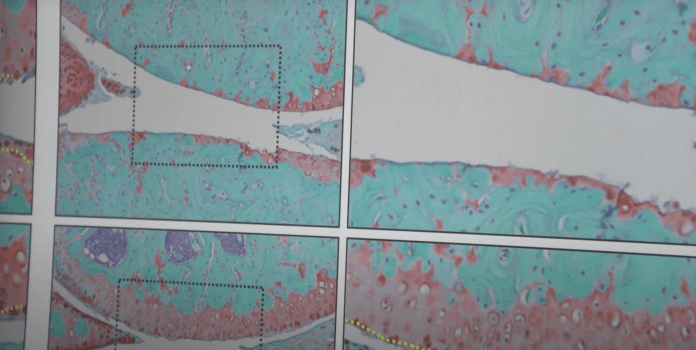 A medical image of bone and joint tissue