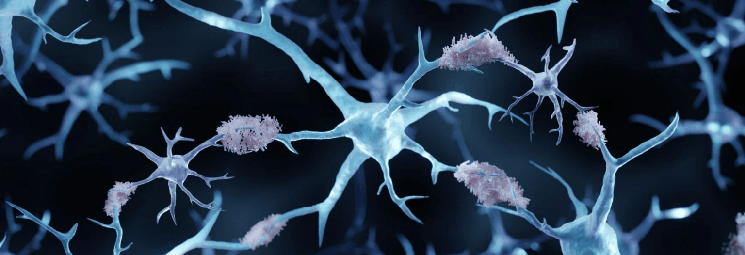 Microscopic image of dendrites and amyloid plaques