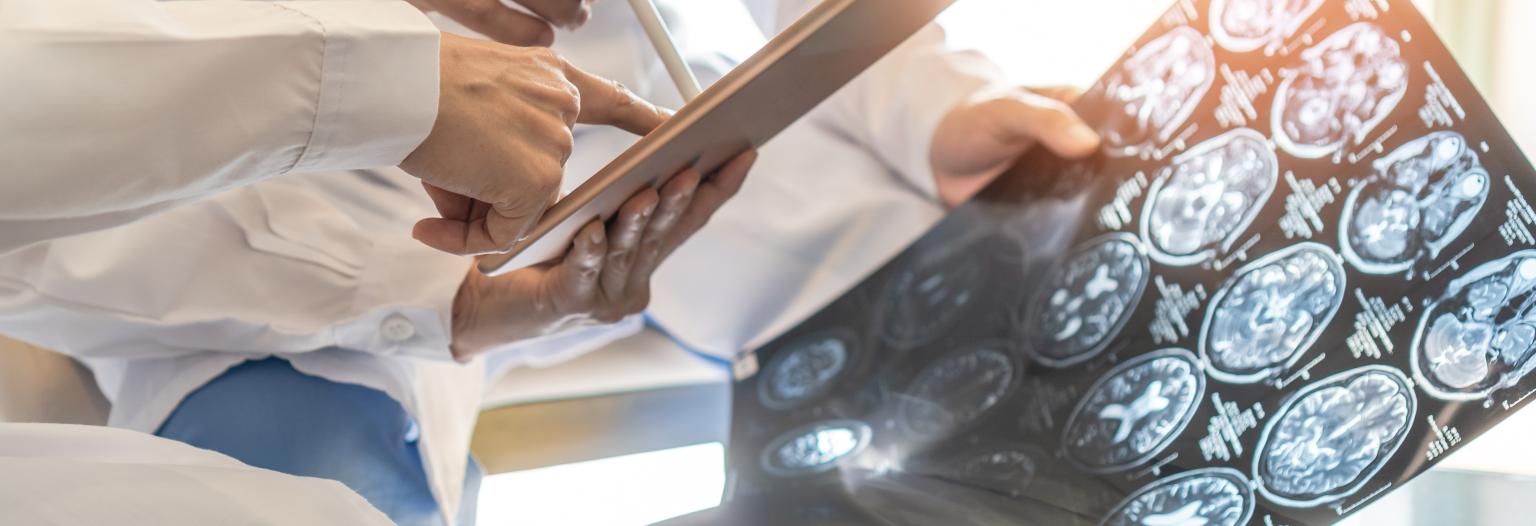 Doctors looking at brain scan